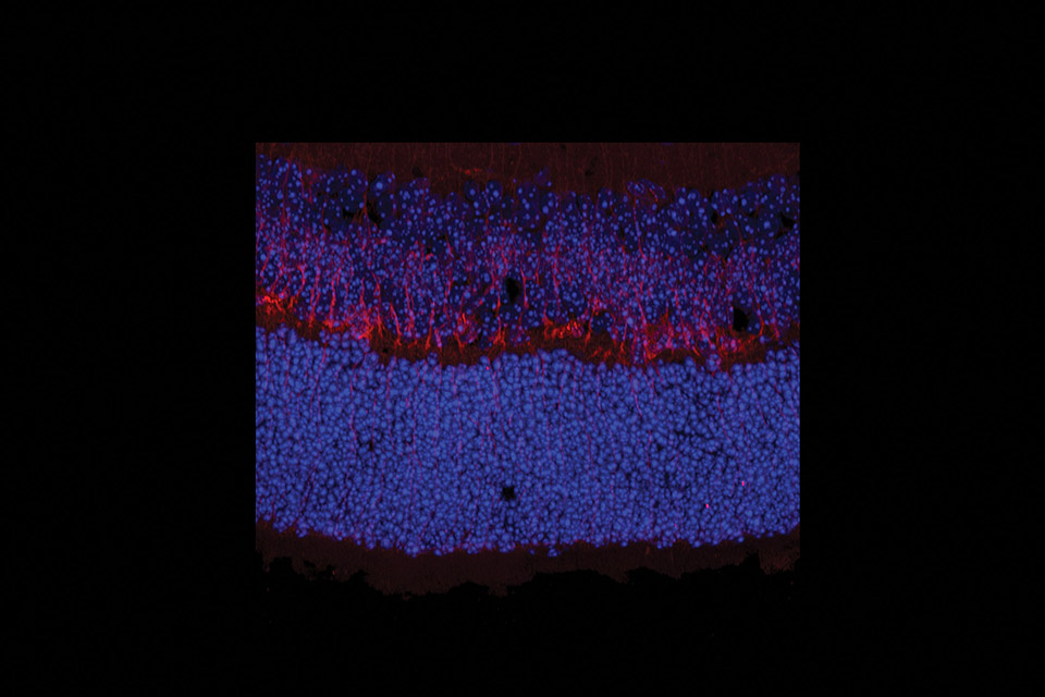 20 micrometer-thin section of the retina of a mouse